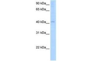 Image no. 1 for anti-Arylacetamide Deacetylase (Esterase) (AADAC) (AA 301-350) antibody (ABIN205073) (AADAC 抗体  (AA 301-350))