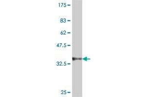 Western Blot detection against Immunogen (35. (Dystrobrevin beta 抗体  (AA 1-89))