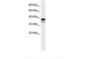 Image no. 1 for anti-Poly (ADP-Ribose) Polymerase Family, Member 6 (PARP6) (AA 72-121) antibody (ABIN202705) (PARP6 抗体  (AA 72-121))