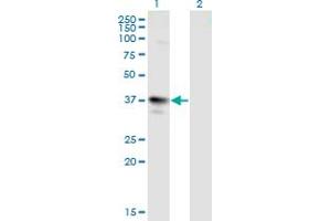 Western Blot analysis of MAGEA3 expression in transfected 293T cell line by MAGEA3 monoclonal antibody (M01), clone 6D10. (MAGEA3 抗体  (AA 44-114))