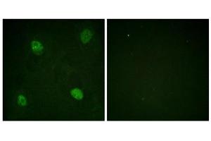 Immunofluorescence analysis of HeLa cells, using hnRPD (Phospho-Ser83) antibody. (HNRNPD/AUF1 抗体  (pSer83))