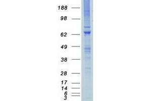 Western Blotting (WB) image for Myosin Light Chain Kinase 2 (MYLK2) protein (Myc-DYKDDDDK Tag) (ABIN2726092)