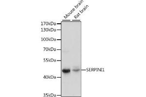 Western blot analysis of extracts of various cell lines, using SERPINI1 antibody (ABIN7270251) at 1:1000 dilution. (Neuroserpin 抗体  (AA 181-410))