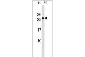 Western blot analysis in HL-60 cell line lysates (35ug/lane). (TMED6 抗体  (AA 125-153))