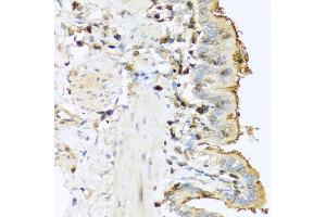 Immunohistochemistry of paraffin-embedded mouse lung using PRSS1 antibody at dilution of 1:100 (40x lens). (PRSS1 抗体)