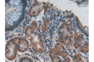 Immunohistochemistry (IHC) image for anti-Relaxin/insulin-Like Family Peptide Receptor 1 (RXFP1) (AA 260-409) antibody (ABIN7438106)