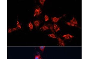 Immunofluorescence analysis of C6 cells using ADAM11 Polyclonal Antibody at dilution of 1:100. (ADAM11 抗体)