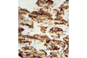Immunohistochemistry (IHC) image for anti-Insulin-Like Growth Factor Binding Protein 4 (IGFBP4) antibody (ABIN3002898) (IGFBP4 抗体)