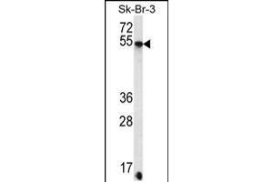 Western blot analysis in SK-BR-3 cell line lysates (35ug/lane). (SDC3 抗体  (C-Term))