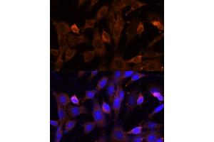 Immunofluorescence analysis of NIH-3T3 cells using VPS36 Polyclonal Antibody (ABIN7271277) at dilution of 1:100 (40x lens).