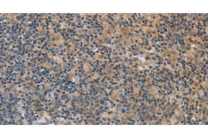 Immunohistochemistry of paraffin-embedded Human tonsil using FXYD1 Polyclonal Antibody at dilution of 1:60 (FXYD1 抗体)
