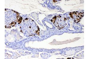 IHC analysis of RBP4 using anti-RBP4 antibody . (RBP4 抗体  (AA 19-201))
