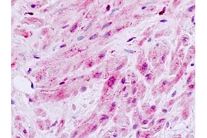Human, Prostate, smooth muscle: Formalin-Fixed Paraffin-Embedded (FFPE) (MAP3K9 抗体  (Internal Region))