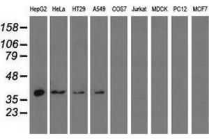 Western blot analysis of extracts (35 µg) from 9 different cell lines by using anti-HIBCH monoclonal antibody. (HIBCH 抗体)