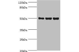 Western blot All lanes: TERF1 antibody at 2 μg/mL Lane 1: k562 whole cell lysate Lane 2: 293T whole cell lysate Lane 3: Jurkat whole cell lysate Secondary Goat polyclonal to rabbit IgG at 1/10000 dilution Predicted band size: 51, 49 kDa Observed band size: 51 kDa (TRF1 抗体  (AA 260-439))