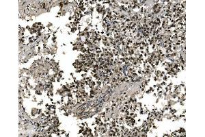 anti-Forkhead Box A2 (FOXA2) (AA 139-446) antibody