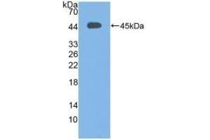 Detection of Recombinant C3c, Human using Polyclonal Antibody to Complement C3 Convertase (C3 Convertase) (Complement C3 Convertase 抗体)