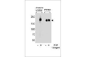 Western blot analysis of extracts from A431 cells,untreated or treated with EGF,100 ng/mL ,using phospho ERBB2-(left) or ERBB2 Antibody (right) (ErbB2/Her2 抗体  (pTyr1127))