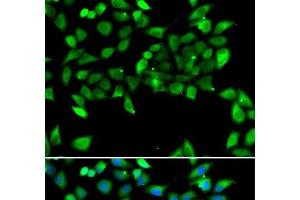 Immunofluorescence analysis of U2OS cells using EIF3H Polyclonal Antibody (EIF3H 抗体)