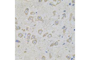 Immunohistochemistry of paraffin-embedded mouse brain using EIF3F Antibody (ABIN2562388) at dilution of 1:100 (40x lens).