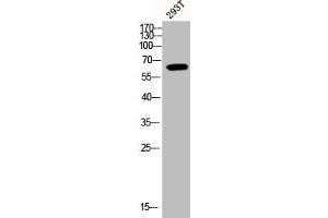 Western Blot analysis of 293T cells using Phospho-Akt1 (Y474) Polyclonal Antibody (AKT1 抗体  (pTyr474))