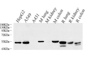 Western Blot analysis of various samples using CK-7 Monoclonal Antibody at dilution of 1:1000. (Cytokeratin 7 抗体)
