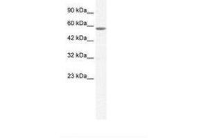 Image no. 2 for anti-General Transcription Factor IIE, Polypeptide 1, alpha 56kDa (GTF2E1) (C-Term) antibody (ABIN6736041) (GTF2E1 抗体  (C-Term))
