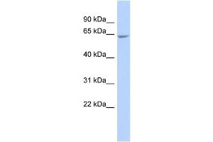 WB Suggested Anti-GALNTL4 Antibody Titration:  0. (UDP-N-Acetyl-alpha-D-Galactosamine:polypeptide N-Acetylgalactosaminyltransferase 18 (GALNT18) (Middle Region) 抗体)