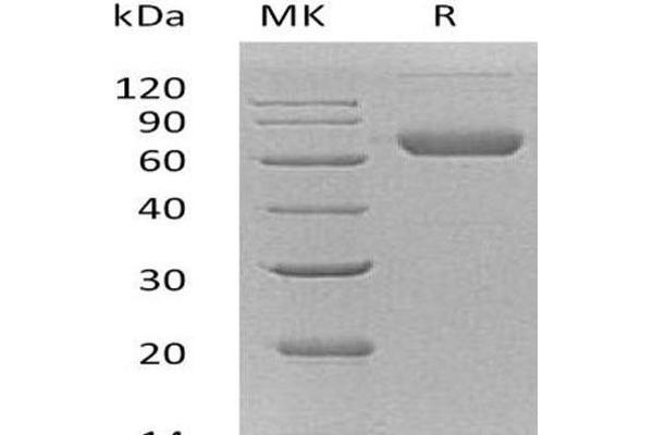 Ephrin B2 Protein (EFNB2) (His tag,Fc Tag)