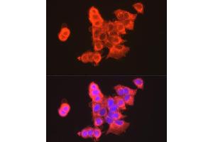 Immunofluorescence analysis of MCF7 cells using CLDN3 antibody (ABIN3017039, ABIN3017040, ABIN3017041, ABIN1679261 and ABIN6219930) at dilution of 1:100. (Claudin 3 抗体)