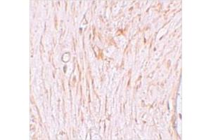 Immunohistochemistry of ZBTB7A in Human ovary tissue with ZBTB7A / Pokemon antibody at 2. (ZBTB7A 抗体  (N-Term))