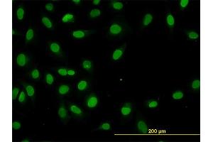 Immunofluorescence of monoclonal antibody to HNF4A on HeLa cell. (HNF4A 抗体  (AA 324-423))
