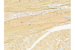 ABIN6260856 and ABIN6273101 at 1/100 staining human tongue carcinoma by IHC-P. (CKMT1 抗体  (N-Term))