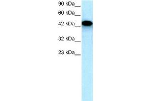 WB Suggested Anti-EYA3 Antibody Titration:  0. (EYA3 抗体  (Middle Region))