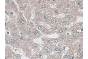 Detection of AK2 in Rat Liver Tissue using Polyclonal Antibody to Adenylate Kinase 2 (AK2) (Adenylate Kinase 2 抗体  (AA 64-232))