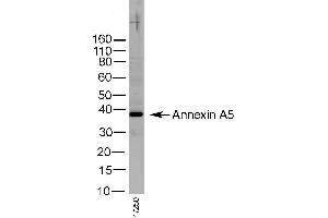 Western Blotting (WB) image for anti-Annexin A5 (ANXA5) antibody (ABIN2477449) (Annexin V 抗体)