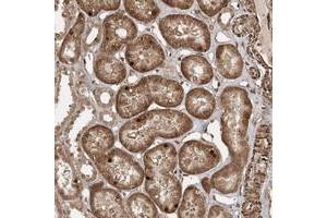 Immunohistochemical staining of human kidney with ETAA1 polyclonal antibody  shows distinct nuclear and cytoplasmic positivity in tubular cells. (ETAA1 抗体)