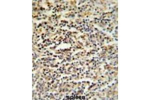 Immunohistochemistry (IHC) image for anti-Coiled-Coil Domain Containing 101 (CCDC101) antibody (ABIN3002249)