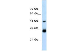 WB Suggested Anti-HOXC9 Antibody Titration:  2. (HOXC9 抗体  (Middle Region))