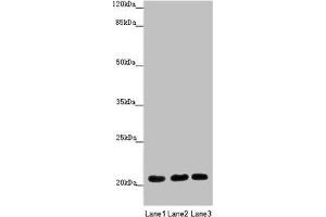 Western blot All lanes: MOCS2 antibody at 1. (MOCS2 抗体  (Catalytic Subunit))