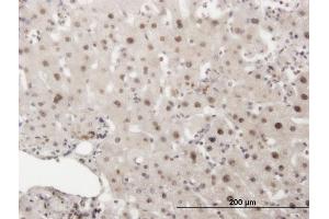 Immunoperoxidase of monoclonal antibody to PRKDC on formalin-fixed paraffin-embedded human liver. (PRKDC 抗体  (AA 4019-4128))