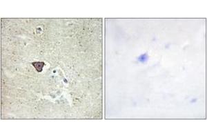 Immunohistochemistry analysis of paraffin-embedded human brain tissue, using CDH9 Antibody. (Cadherin 9 抗体  (AA 201-250))