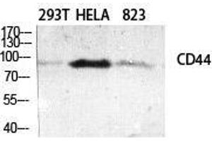Western Blot (WB) analysis of specific cells using CD44 Polyclonal Antibody. (CD44 抗体  (Ser2152))