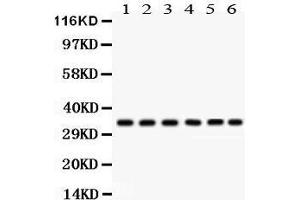 Western Blotting (WB) image for anti-Cyclin-Dependent Kinase 1 (CDK1) (AA 66-297) antibody (ABIN3043473)