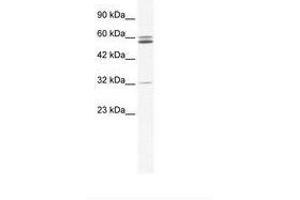 Image no. 1 for anti-Zinc Finger Protein 491 (ZNF491) (AA 51-100) antibody (ABIN6735997) (ZNF491 抗体  (AA 51-100))