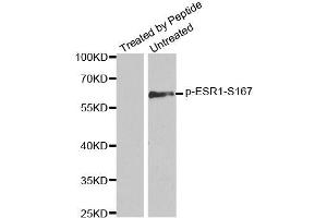 Western blot analysis of extracts from MCF7 cells using Phospho-ESR1-S167 antibody (ABIN2988007). (Estrogen Receptor alpha 抗体  (pSer167))
