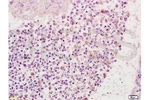 Formalin-fixed and paraffin embedded rat brain tissue labeled with Anti-CD64/IGFR1 Polyclonal Antibody, Unconjugated (ABIN747413) at 1:200 followed by conjugation to the secondary antibody and DAB staining