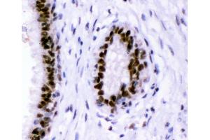 IHC analysis of p95 NBS1 using anti-p95 NBS1 antibody (ABIN3043282). (Nibrin 抗体  (C-Term))