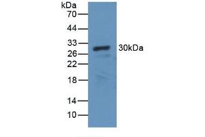 Detection of Recombinant CA2, Canine using Polyclonal Antibody to Carbonic Anhydrase II (CA2) (CA2 抗体)