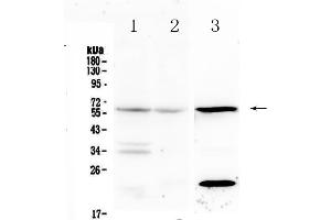 Western blot analysis of IL23 Receptor using anti-IL23 Receptor antibody . (IL23R 抗体  (AA 25-233))